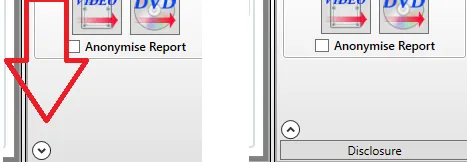 The Disclosure button at the bottom of the report toolbar.